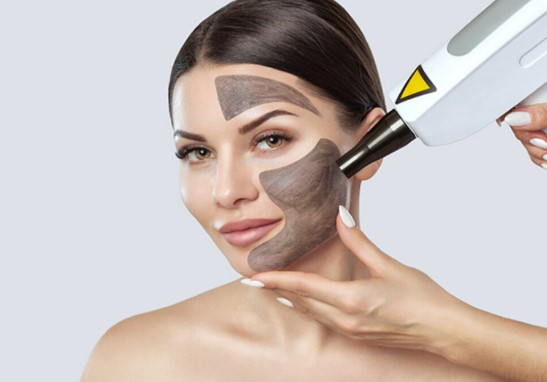 Karbon Peeling Lazer