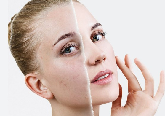 Medikal Leke Tedavisi