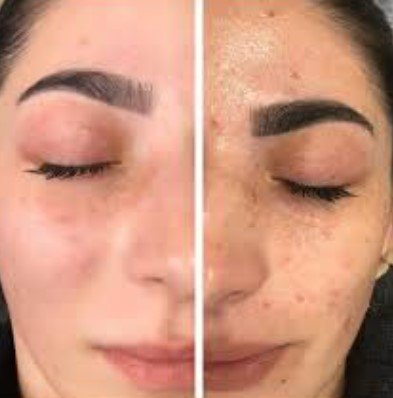 Prenses Bakım Uygulama Detay