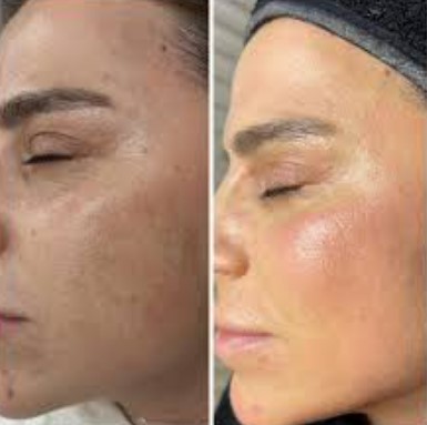 Prenses VIP Cilt Bakımı